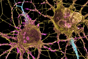 Researchers at the K. Lisa Yang and Hock E. Tan Center for Molecular Therapeutics in Neuroscience will initially focus on three major lines of investigation: genetic engineering using CRISPR tools, delivery of genetic and molecular cargo across the blood-brain barrier, and the translation of basic research into the clinical setting.