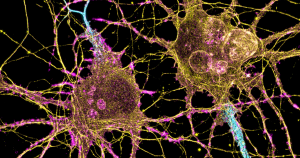 Researchers at the K. Lisa Yang and Hock E. Tan Center for Molecular Therapeutics in Neuroscience will initially focus on three major lines of investigation: genetic engineering using CRISPR tools, delivery of genetic and molecular cargo across the blood-brain barrier, and the translation of basic research into the clinical setting.