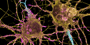 Researchers at the K. Lisa Yang and Hock E. Tan Center for Molecular Therapeutics in Neuroscience will initially focus on three major lines of investigation: genetic engineering using CRISPR tools, delivery of genetic and molecular cargo across the blood-brain barrier, and the translation of basic research into the clinical setting.